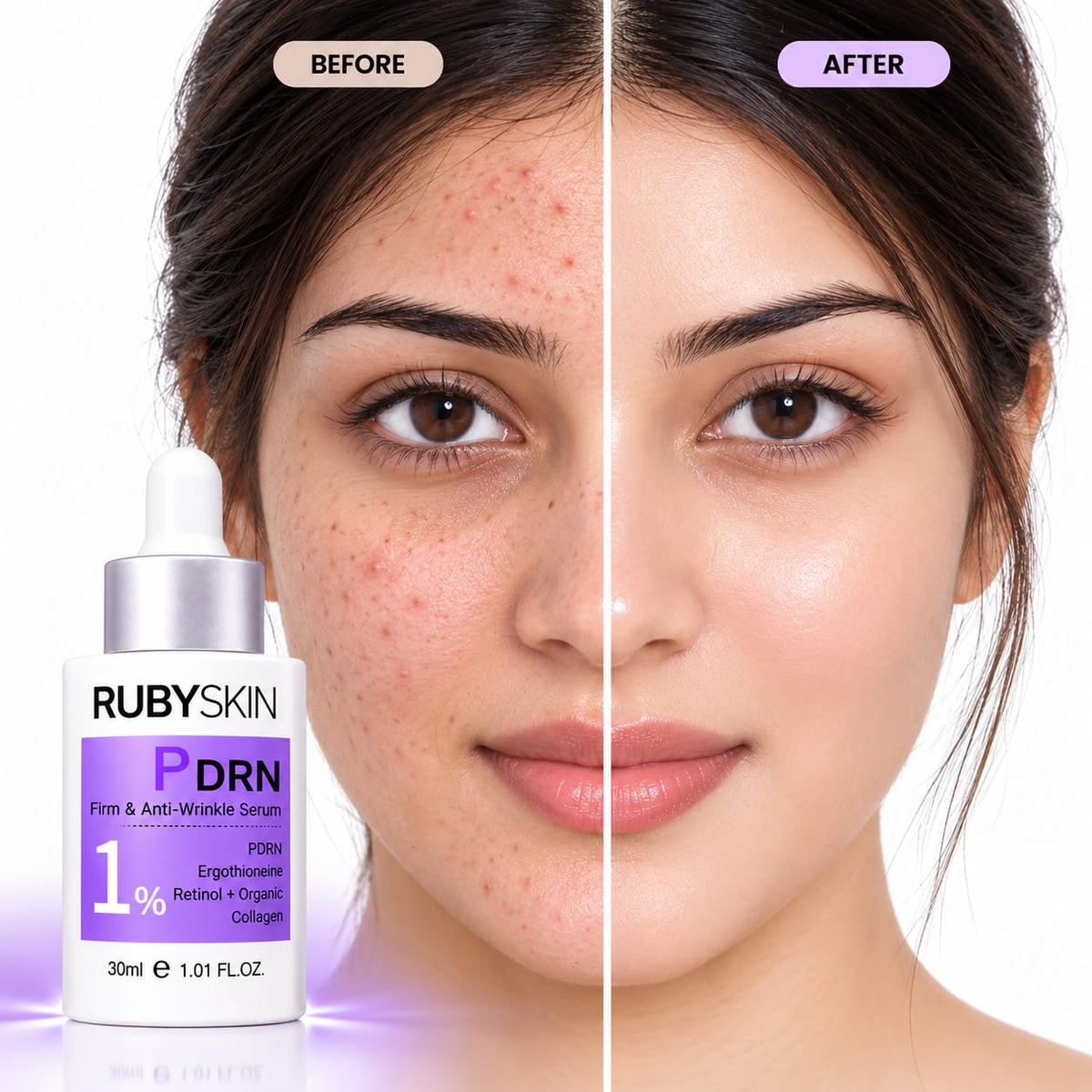 RubySkin PDRN Retinol Anti Wrinkle Serum 30ml