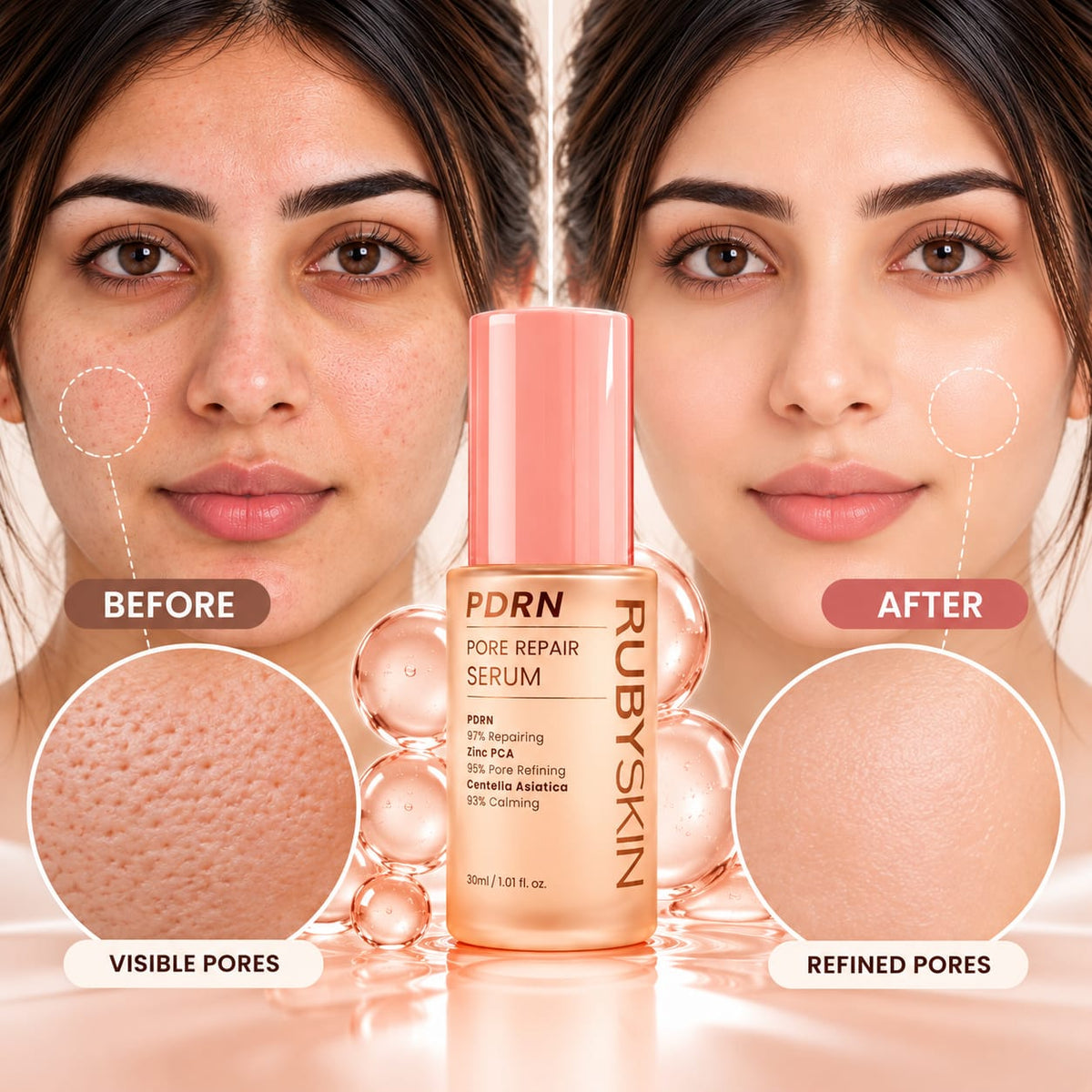 RubySkin PDRN Pore Repair Serum