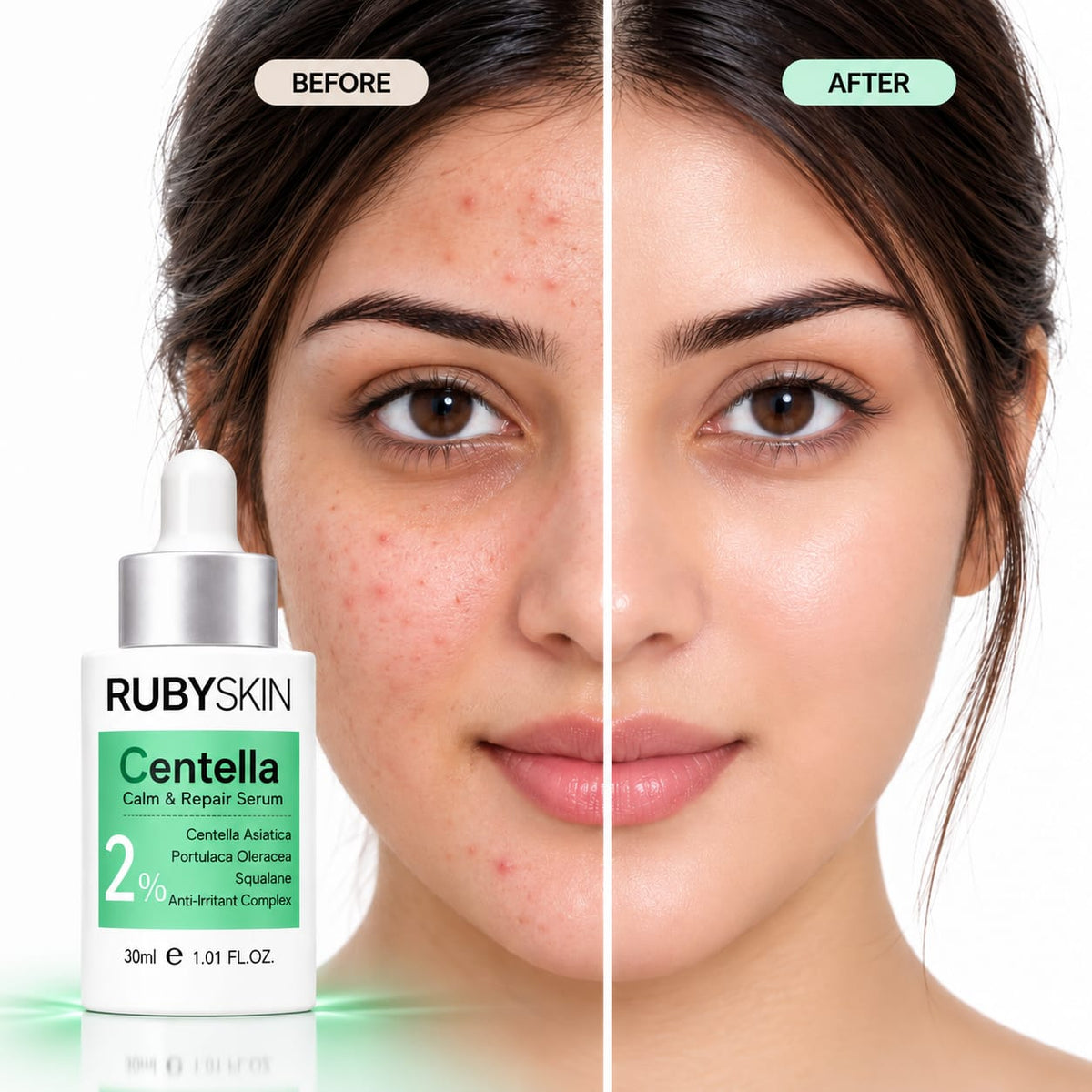 RubySkin Centella Calm and Repair Serum 30ml
